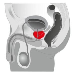 Prostatos masažuoklis Booster